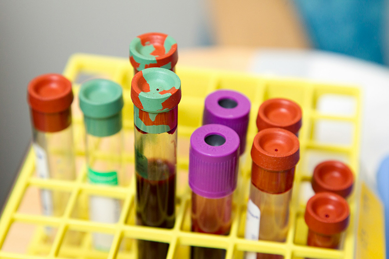 Preventative-Care-Screening-in-Calera-Alabama